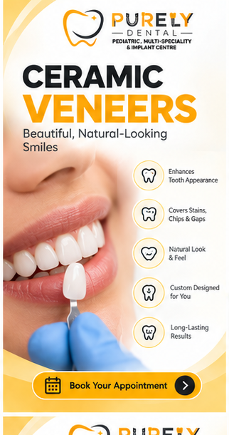 CERAMIC VENEERS